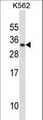 PRL / Prolactin Antibody - PRL Antibody western blot of K562 cell line lysates (35 ug/lane). The PRL antibody detected the PRL protein (arrow).