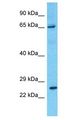 PRLR / Prolactin Receptor Antibody - PRLR / Prolactin Receptor antibody Western Blot of Lymph Node Tumor. Antibody dilution: 1 ug/ml.  This image was taken for the unconjugated form of this product. Other forms have not been tested.