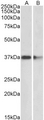PRMT2 Antibody - Goat Anti-PRMT2 Antibody (2µg/ml) staining of Mouse (A) and Rat (B) Brain lysates (35µg protein in RIPA buffer). Primary incubation was 1 hour. Detected by chemiluminescencence.