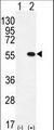 PRMT2 Antibody - Western blot of PRMT2 (arrow) using rabbit polyclonal PRMT2 Antibody (L359). 293 cell lysates (2 ug/lane) either nontransfected (Lane 1) or transiently transfected (Lane 2) with the PRMT2 gene.