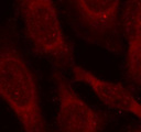 PRMT4 / CARM1 Antibody - Immunofluorescence staining of methanol-fixed HeLa cells.