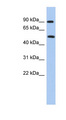 PRMT7 Antibody - PRMT7 antibody Western blot of Fetal Liver lysate. This image was taken for the unconjugated form of this product. Other forms have not been tested.