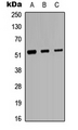 PROC / Protein C Antibody - Western blot analysis of Protein C expression in HeLa (A); Raw264.7 (B); H9C2 (C) whole cell lysates.