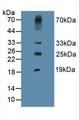 Procollagen III N-Terminal Propeptide Antibody