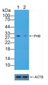 Prohibitin Antibody - Knockout Varification: Lane 1: Wild-type Hela cell lysate; Lane 2: PHB knockout Hela cell lysate; Predicted MW: 17,30kd Observed MW: 30kd Primary Ab: 2µg/ml Rabbit Anti-Human PHB Antibody Second Ab: 0.2µg/mL HRP-Linked Caprine Anti-Rabbit IgG Polyclonal Antibody