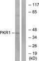 PROKR1 Antibody - Western blot analysis of lysates from COLO cells, using PKR1 Antibody. The lane on the right is blocked with the synthesized peptide.