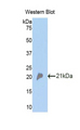 Properdin / CFP Antibody - Western blot of recombinant Properdin / CFP.  This image was taken for the unconjugated form of this product. Other forms have not been tested.