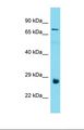 PROSER3 Antibody - Western blot of Human Thyroid Tumor. C19orf55 antibody dilution 1.0 ug/ml.  This image was taken for the unconjugated form of this product. Other forms have not been tested.