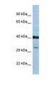 Prostaglandin D2 Receptor Antibody - PTGDR antibody Western blot of 1 Cell lysate. Antibody concentration 1 ug/ml.  This image was taken for the unconjugated form of this product. Other forms have not been tested.