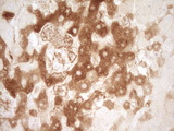 PROZ / Protein Z Antibody - IHC of paraffin-embedded Human liver tissue using anti-PROZ mouse monoclonal antibody. (Heat-induced epitope retrieval by 1 mM EDTA in 10mM Tris, pH8.5, 120°C for 3min).