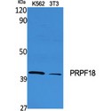 PRPF18 Antibody - Western blot of PRPF18 antibody