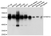 PRPF4 Antibody - Western blot analysis of extracts of various cell lines.