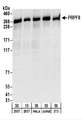 PRPF8 Antibody - Detection of Human and Mouse PRPF8 by Western Blot. Samples: Whole cell lysate from 293T (15 and 50 ug), HeLa (50 ug), Jurkat (50 ug), and mouse NIH3T3 (50 ug) cells. Antibodies: Affinity purified rabbit anti-PRPF8 antibody used for WB at 0.1 ug/ml. Detection: Chemiluminescence with an exposure time of 30 seconds.