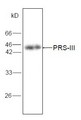 PRPS1L1 Antibody