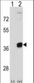 PRPS2 Antibody - Western blot of PRPS2 (arrow) using rabbit polyclonal PRPS2 Antibody. 293 cell lysates (2 ug/lane) either nontransfected (Lane 1) or transiently transfected (Lane 2) with the PRPS2 gene.