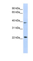 PRR11 Antibody - PRR11 antibody Western blot of HepG2 cell lysate. This image was taken for the unconjugated form of this product. Other forms have not been tested.