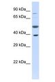PRR11 Antibody - PRR11 antibody Western Blot of Fetal Liver. Antibody dilution: 1 ug/ml.  This image was taken for the unconjugated form of this product. Other forms have not been tested.