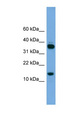 PRR15 Antibody - PRR15 antibody Western blot of Jurkat lysate. This image was taken for the unconjugated form of this product. Other forms have not been tested.