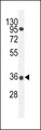 PRR19 Antibody - PRR19 Antibody western blot of A549 cell line lysates (35 ug/lane). The PRR19 antibody detected the PRR19 protein (arrow).