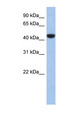 PRR30 Antibody - C2orf53 antibody Western blot of 721_B cell lysate. This image was taken for the unconjugated form of this product. Other forms have not been tested.