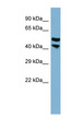 PRR5L / FLJ14213 Antibody - PRR5L / FLJ14213 antibody Western blot of THP-1 cell lysate. This image was taken for the unconjugated form of this product. Other forms have not been tested.