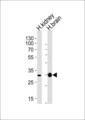 PRRG3 / TMG3 Antibody - Western blot of lysates from human kidney and brain tissue lysates (from left to right), using PRRG3 Antibody. Antibody was diluted at 1:1000 at each lane. A goat anti-rabbit IgG H&L (HRP) at 1:5000 dilution was used as the secondary antibody. Lysates at 35ug per lane.