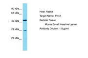 PRRX2 / PRX2 Antibody -  This image was taken for the unconjugated form of this product. Other forms have not been tested.