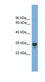 PRRX2 / PRX2 Antibody - PRRX2 antibody Western blot of Fetal Heart lysate. This image was taken for the unconjugated form of this product. Other forms have not been tested.