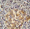 PRSS3 / Trypsin 3 Antibody - PRSS3 antibody immunohistochemistry of formalin-fixed and paraffin-embedded human pancreas tissue followed by peroxidase-conjugated secondary antibody and DAB staining.