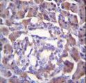 PRSS3 / Trypsin 3 Antibody - PRSS3 Antibody immunohistochemistry of formalin-fixed and paraffin-embedded human pancreas tissue followed by peroxidase-conjugated secondary antibody and DAB staining.