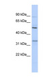 PRSS35 Antibody - PRSS35 antibody Western blot of 721_B cell lysate. This image was taken for the unconjugated form of this product. Other forms have not been tested.