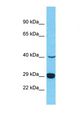 PRSS37 Antibody - Western blot of Human HepG2. PRSS37 antibody dilution 1.0 ug/ml.  This image was taken for the unconjugated form of this product. Other forms have not been tested.