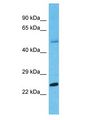 PRSS45 Antibody - PRSS45 antibody Western Blot of Fetal Liver. Antibody dilution: 1 ug/ml.  This image was taken for the unconjugated form of this product. Other forms have not been tested.