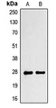 PRX-1 / PRRX1 Antibody - Western blot analysis of PRRX1 expression in NCIH292 (A); NIH3T3 (B) whole cell lysates.