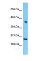 PRY Antibody - Western blot of PRY Antibody with A549 Whole Cell lysate.  This image was taken for the unconjugated form of this product. Other forms have not been tested.