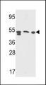 PSAP / Prosaposin Antibody - Western blot of SAP Antibody (Center E300) in Y79,A2058,CEM cell line lysates(35 ug/lane). SAP (arrow) was detected using the purified antibody.