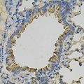 PSAT1 Antibody - Immunohistochemistry of paraffin-embedded mouse lung using PSAT1 Antibody at dilution of 1:100 (40x lens).
