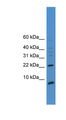 PSCA Antibody - PSCA antibody Western blot of 721_B cell lysate. This image was taken for the unconjugated form of this product. Other forms have not been tested.