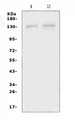 PSD Antibody - Western blot analysis of PSD using anti-PSD antibody. Electrophoresis was performed on a 5-20% SDS-PAGE gel at 70V (Stacking gel) / 90V (Resolving gel) for 2-3 hours. The sample well of each lane was loaded with 50ug of sample under reducing conditions. Lane 1: rat brain tissue lysates,Lane 2: mouse brain tissue lysates. After Electrophoresis, proteins were transferred to a Nitrocellulose membrane at 150mA for 50-90 minutes. Blocked the membrane with 5% Non-fat Milk/ TBS for 1.5 hour at RT. The membrane was incubated with rabbit anti-PSD antigen affinity purified polyclonal antibody at 0.5 µg/mL overnight at 4°C, then washed with TBS-0.1% Tween 3 times with 5 minutes each and probed with a goat anti-rabbit IgG-HRP secondary antibody at a dilution of 1:10000 for 1.5 hour at RT. The signal is developed using an Enhanced Chemiluminescent detection (ECL) kit with Tanon 5200 system. A specific band was detected for PSD at approximately 130KD. The expected band size for PSD is at 109KD.