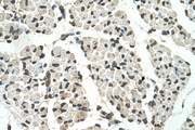 PSD3 Antibody - PSD3 antibody ARP42443_T100-NP_996792-PSD3(pleckstrin and Sec7 domain containing 3) Antibody IHC of formalin-fixed, paraffin-embedded human Muscle. Positive label: Skeletal muscle cells indicated with arrows. Antibody concentration 4-8 ug/ml. Magnification 400X.  This image was taken for the unconjugated form of this product. Other forms have not been tested.