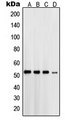 PSEN1 / Presenilin 1 Antibody - Western blot analysis of Presenilin 1 expression in HL60 (A); HeLa (B); SKNMC (C); COS7 (D) whole cell lysates.