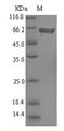 L-ornithine 5-monooxygenase Protein - (Tris-Glycine gel) Discontinuous SDS-PAGE (reduced) with 5% enrichment gel and 15% separation gel.