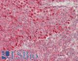PSIP1 / LEDGF Antibody - Human Tonsil: Formalin-Fixed, Paraffin-Embedded (FFPE)