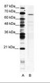 PSIP1 / LEDGF Antibody - A: Marker, B: Jurkat Cell Lysate.  This image was taken for the unconjugated form of this product. Other forms have not been tested.