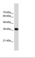 PSIP1 / LEDGF Antibody - HepG2 Cell Lysate.  This image was taken for the unconjugated form of this product. Other forms have not been tested.