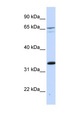 PSIP1 / LEDGF Antibody - PSIP1 antibody Western blot of 721_B cell lysate. This image was taken for the unconjugated form of this product. Other forms have not been tested.