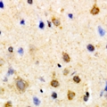 PSKH1 Antibody - Immunohistochemical analysis of PSKH1 staining in human brain formalin fixed paraffin embedded tissue section. The section was pre-treated using heat mediated antigen retrieval with sodium citrate buffer (pH 6.0). The section was then incubated with the antibody at room temperature and detected with HRP and DAB as chromogen. The section was then counterstained with hematoxylin and mounted with DPX.
