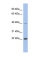 PSMA4 Antibody - PSMA4 antibody Western blot of Fetal Heart lysate. This image was taken for the unconjugated form of this product. Other forms have not been tested.