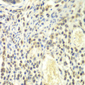 PSMA4 Antibody - Immunohistochemistry of paraffin-embedded human colon tissue.