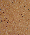 PSMB1 Antibody - Formalin-fixed and paraffin-embedded human brain tissue reacted with PSMB1 Antibody , which was peroxidase-conjugated to the secondary antibody, followed by DAB staining. This data demonstrates the use of this antibody for immunohistochemistry; clinical relevance has not been evaluated.